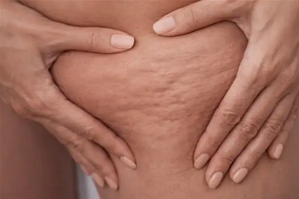 Préparation de crème anti-cellulite maison avec macérâts de plantes