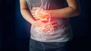 Heartburn, Food and Natural Remedies - Gastroesophageal Reflux Gerd